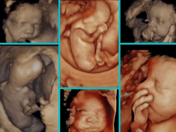 Best 3D 4D Ultrasound Specialist | Dr. Neha Gupta