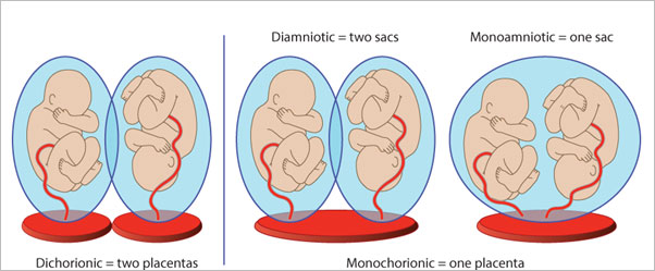 Multiple Pregnancy Scans